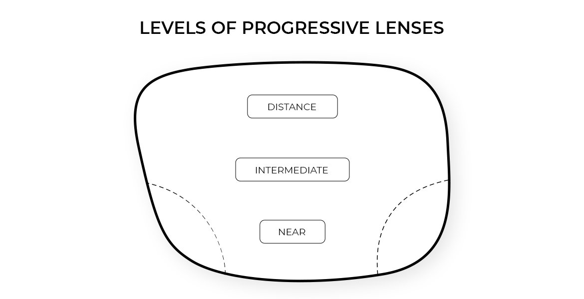 Challenges and Adaptation to Progressive Lenses Bring Notable Downsides